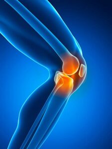 Genou Orthopediste Lausanne